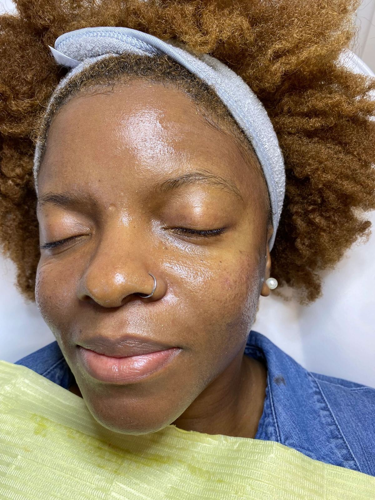 After treatment